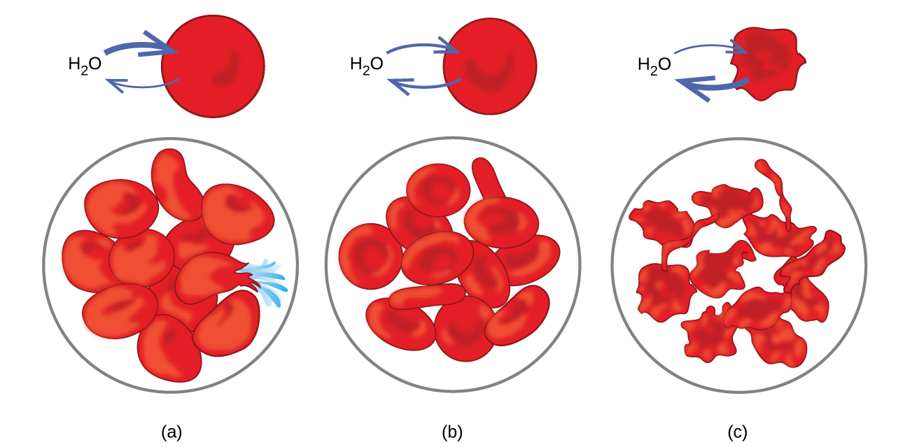 This figure shows three scenarios relating to red blood cell membranes. In a, H subscript 2 O has two arrows drawn from it pointing into a red disk. Beneath it in a circle are eleven similar disks with a bulging appearance, one of which appears to have burst with blue liquid erupting from it. In b, the image is similar except that rather than having two arrows pointing into the red disk, one points in and a second points out toward the H subscript 2 O. In the circle beneath, twelve of the red disks are present. In c, both arrows are drawn from a red shriveled disk toward the H subscript 2 O. In the circle below, twelve shriveled disks are shown.
